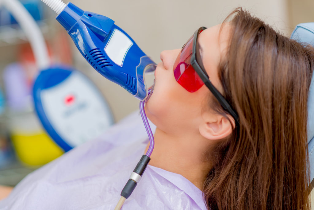 Uv teeth whitening work